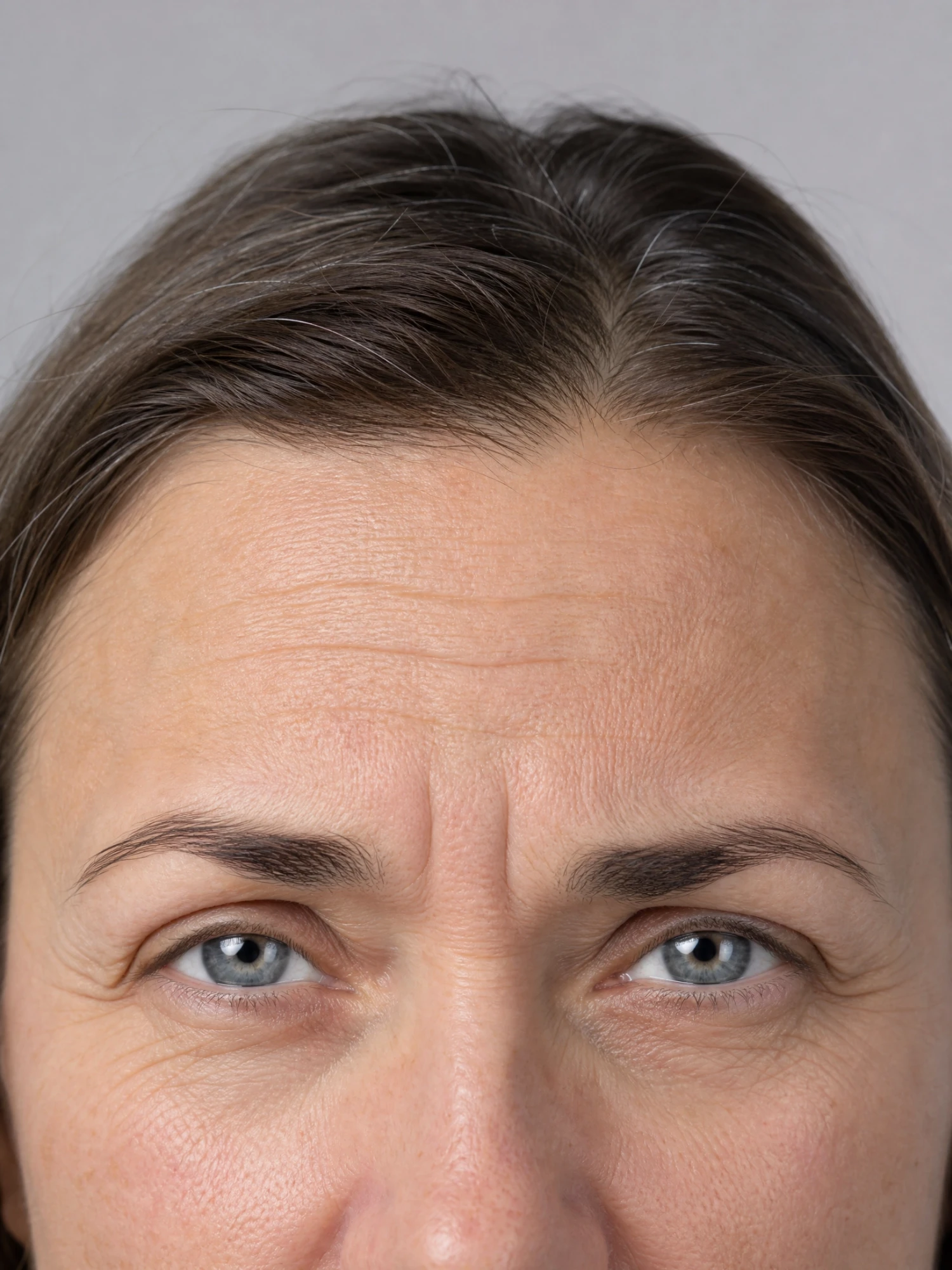 Before treatment (sample)