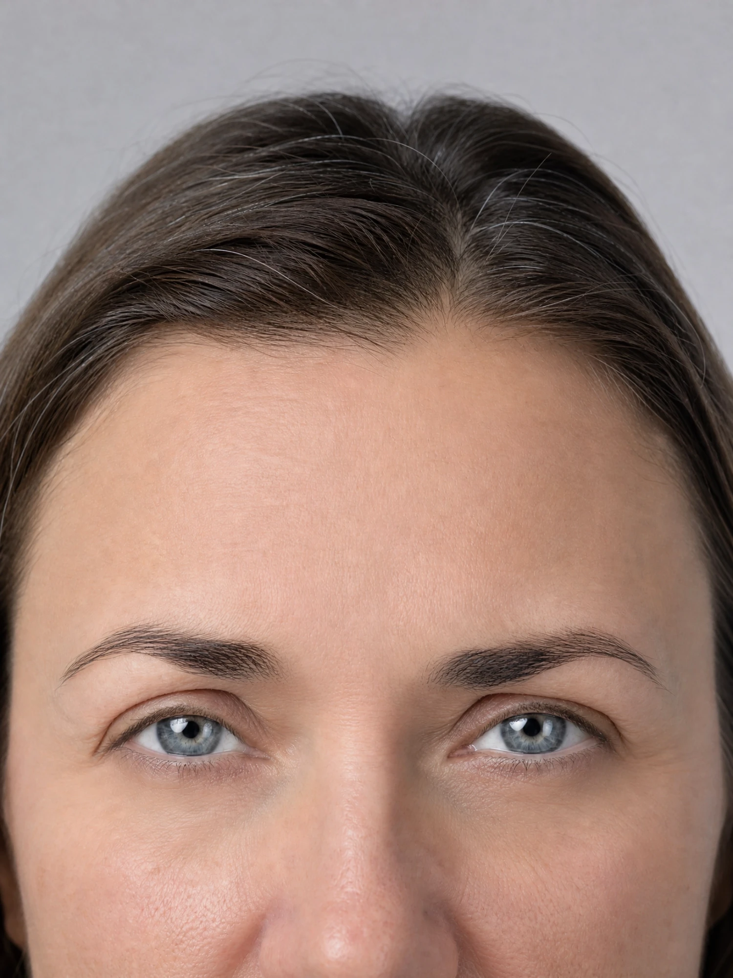 After treatment (sample)